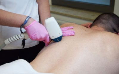 Depilacja laserowa A IPL