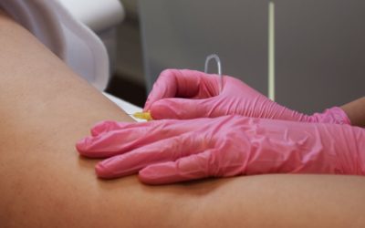 Co to jest karboksyterapia? – jak działa?