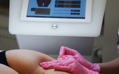 Karboksyterapia Q&A