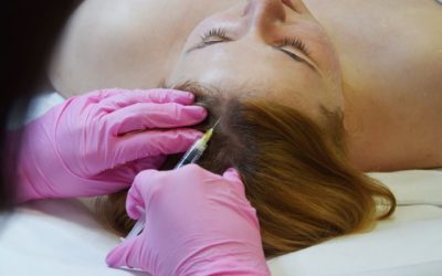 Mezoterapia igłowa Q&A